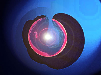 S&uuml;nndag Laetare